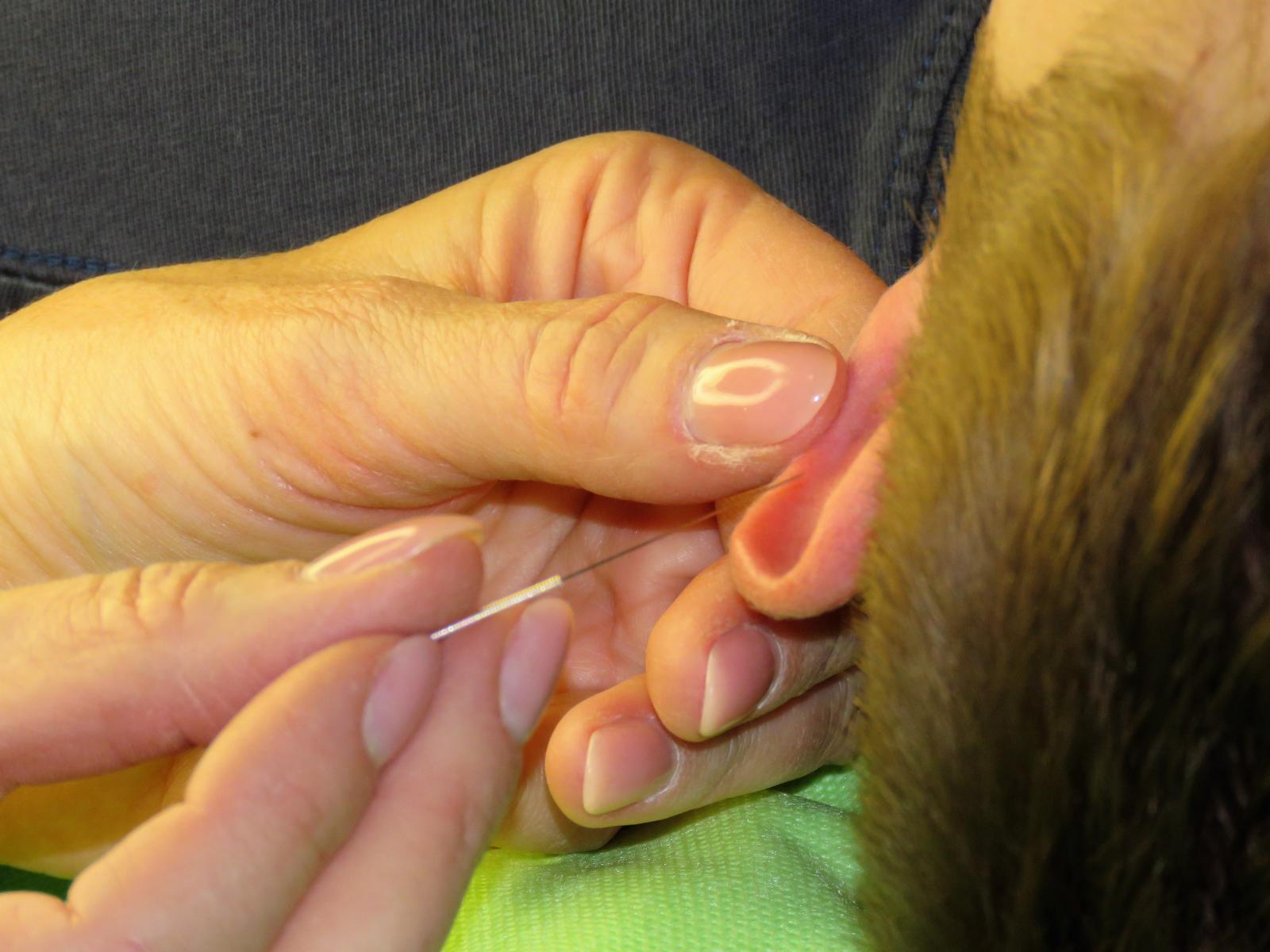 Ohrakupunktur ... eine sehr effektive Therapie